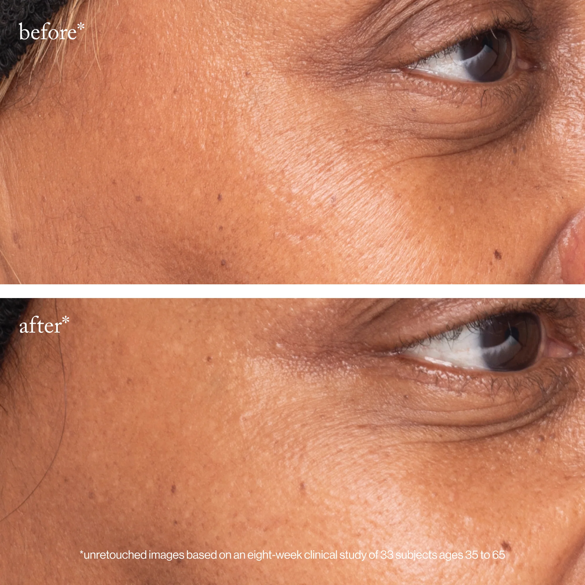 3X Retinol Eye Lift Serum - Image 4