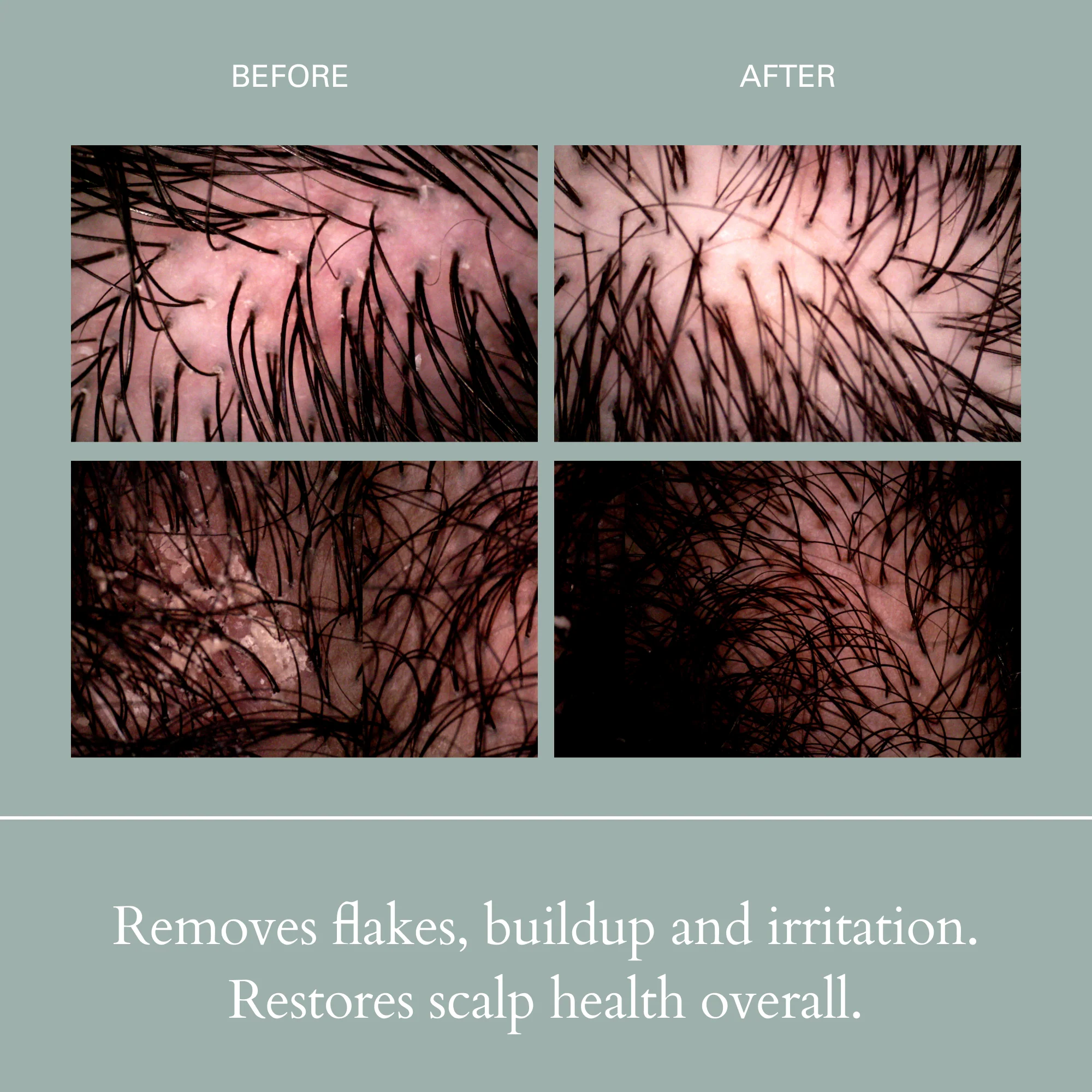 Salt Scalp Scrub Exfoliating Detox Shampoo - Image 5