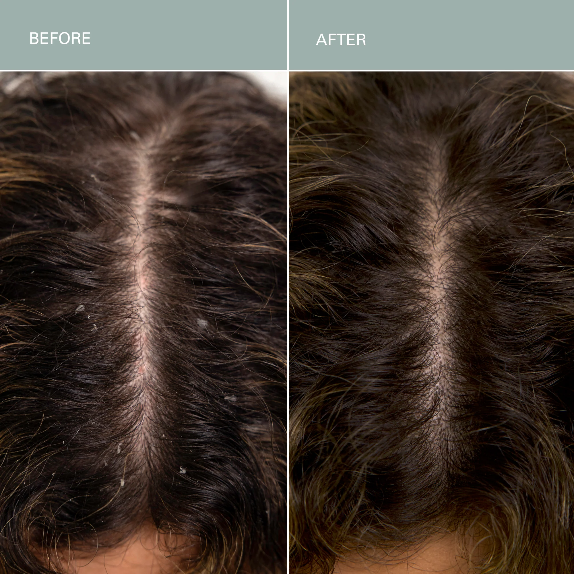 Salt Scalp Scrub Exfoliating Detox Shampoo - Image 6