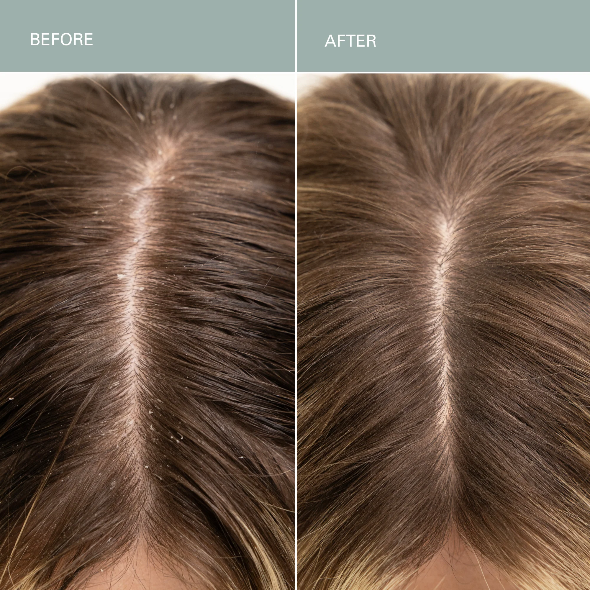 Salt Scalp Scrub Exfoliating Detox Shampoo - Image 7